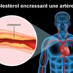 Cholestérol