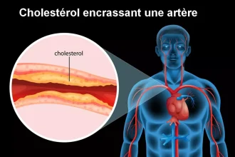 Cholestérol