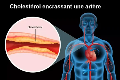 Cholestérol