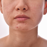 Peau mixte : le guide complet pour équilibrer, hydrater et sublimer votre visage