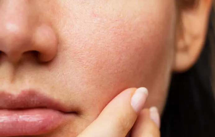 Peau-mixte-le-guide-complet-pour-equilibrer-hydrater-et-sublimer-votre-visage