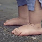 Pieds gonflés