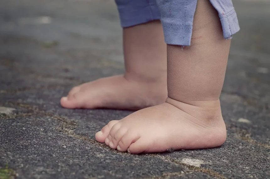Pieds gonflés