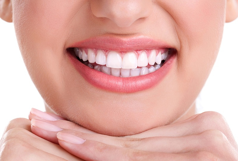 Dents blanches naturellement