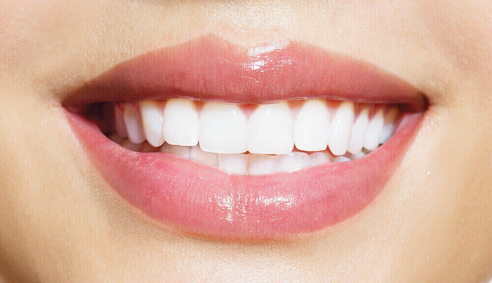 Dents blanches naturellement