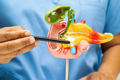 cancer du pancréas