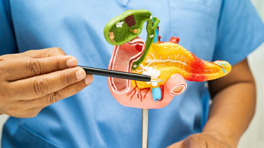 cancer du pancréas