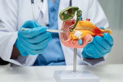 Cancer de pancréas