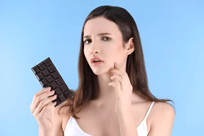 chocolat et acné