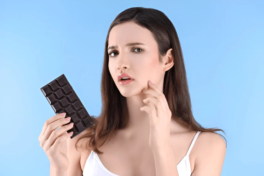chocolat et acné
