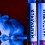 hantavirus des andes