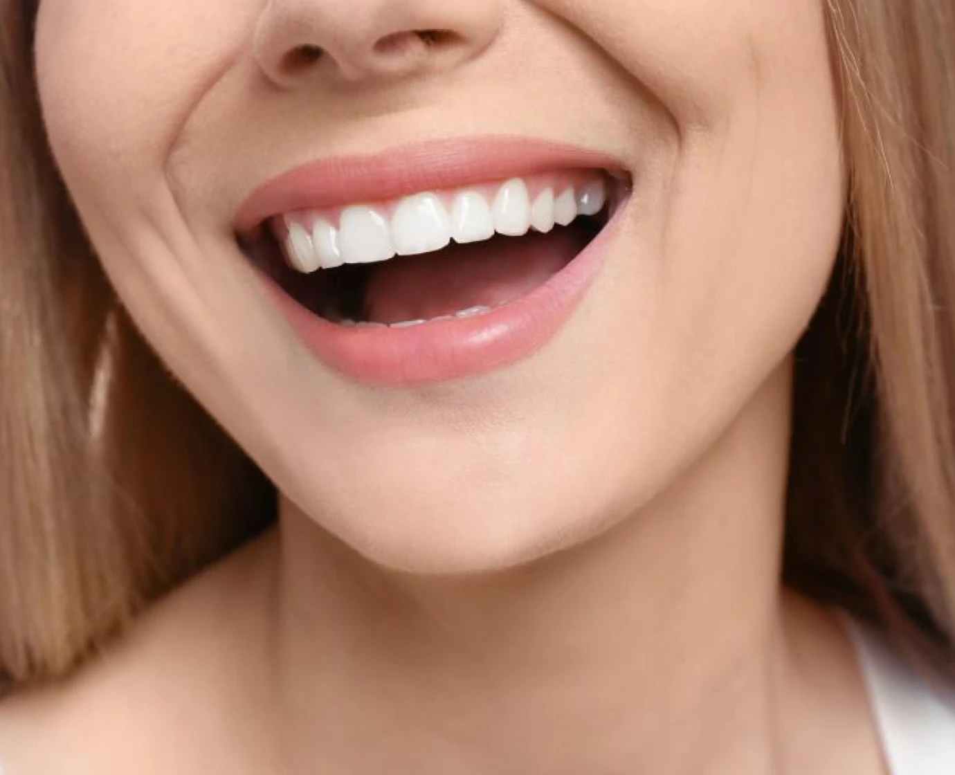 dents