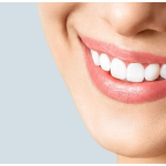 Dents blanches naturellement : 5 méthodes efficaces pour un sourire éclatant et sain