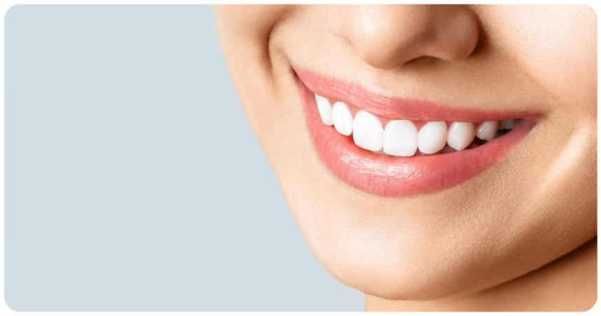 Dents blanches naturellement : 5 méthodes efficaces pour un sourire éclatant et sain
