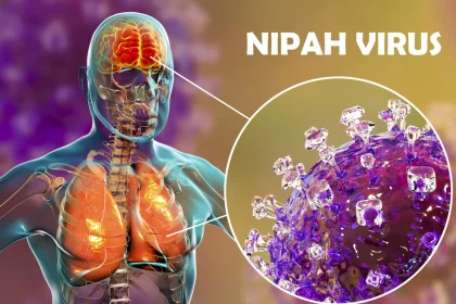 virus Nipah