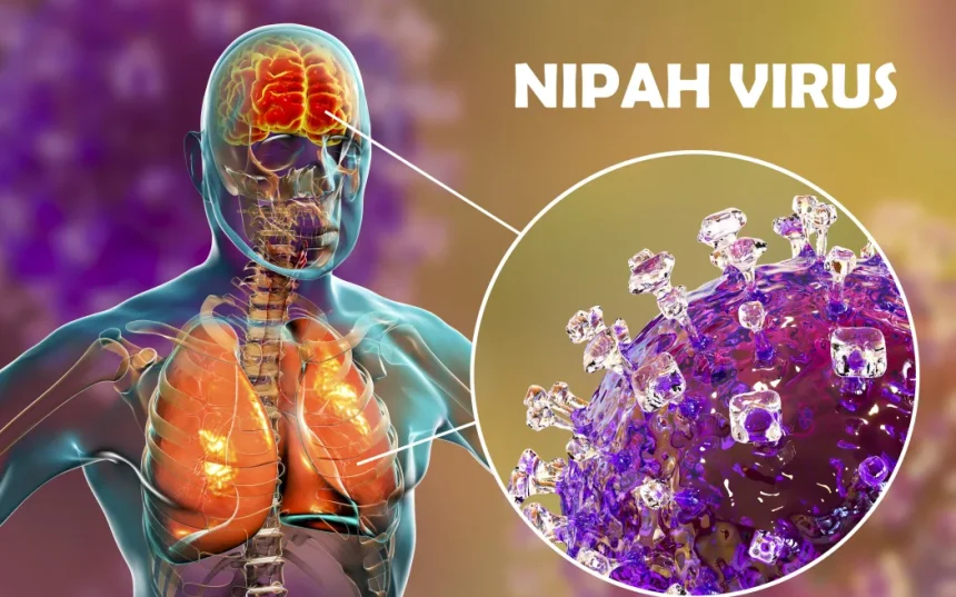 virus Nipah